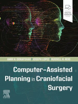 cover image of Computer-Assisted Planning in Craniofacial Surgery--E-Book